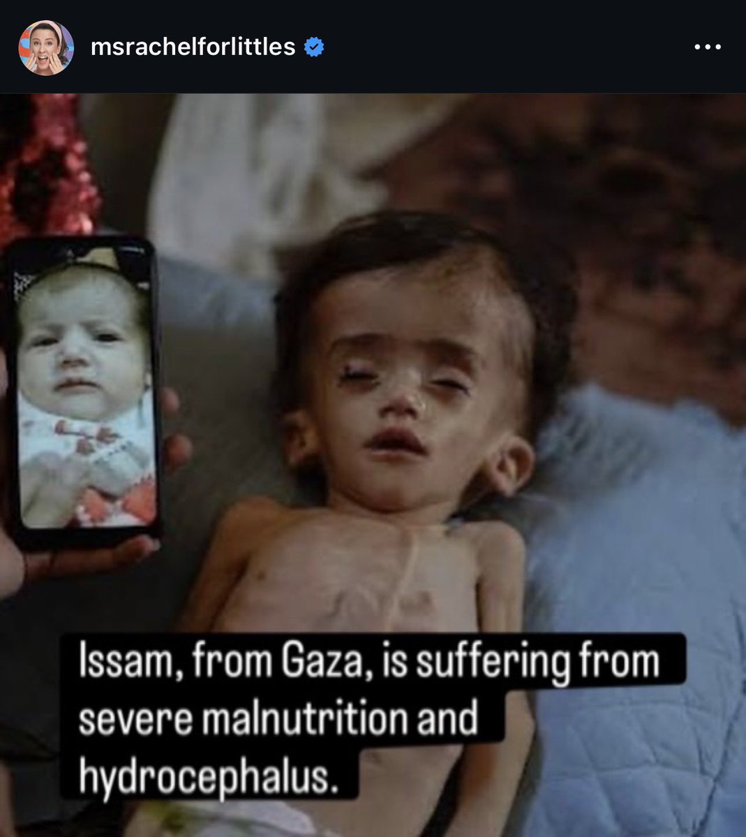 AssalRad's tweet photo. Ms Rachel reports more about Gaza than legacy media. https://t.co/GUVFbfubju