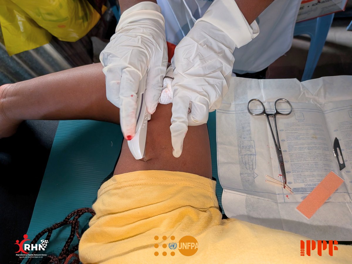rhnkorg's tweet photo. Last week, we took integrated #HIV and #SRH services closer to adolescents and first-time young mothers through our static facility, @RehnetMed and a community outreach at Missions Outreach Church, Tassia Hill.

We worked alongside healthcare providers 🥼from public health facilities, to complement county health services while ensuring more young people could access the care they needed, closer to home.

Over three days, young people walked through our doors to ask questions they had been carrying for months, access contraception💊, get tested for HIV, screen for cervical cancer, receive treatment for common illnesses and connect with healthcare providers who listened without judgment.

By the end of the outreach, over 690 adolescents and first-time young mothers👩🏾‍🍼 had accessed integrated health services.

That's over 650 reasons why bringing healthcare closer to communities matters.

This outreach was made possible with support from @UNFPAKen and in collaboration with the @NairobiCityGov. 
We are grateful to our healthcare providers, community partners and everyone who helped make these three days possible.

Because sometimes, changing a life doesn't begin with a major breakthrough.
It begins by bringing care closer to the people who need it most. 💙

#SystemsThatWorkForHer #FirstTimeYoungMothers #RHNK4Impact