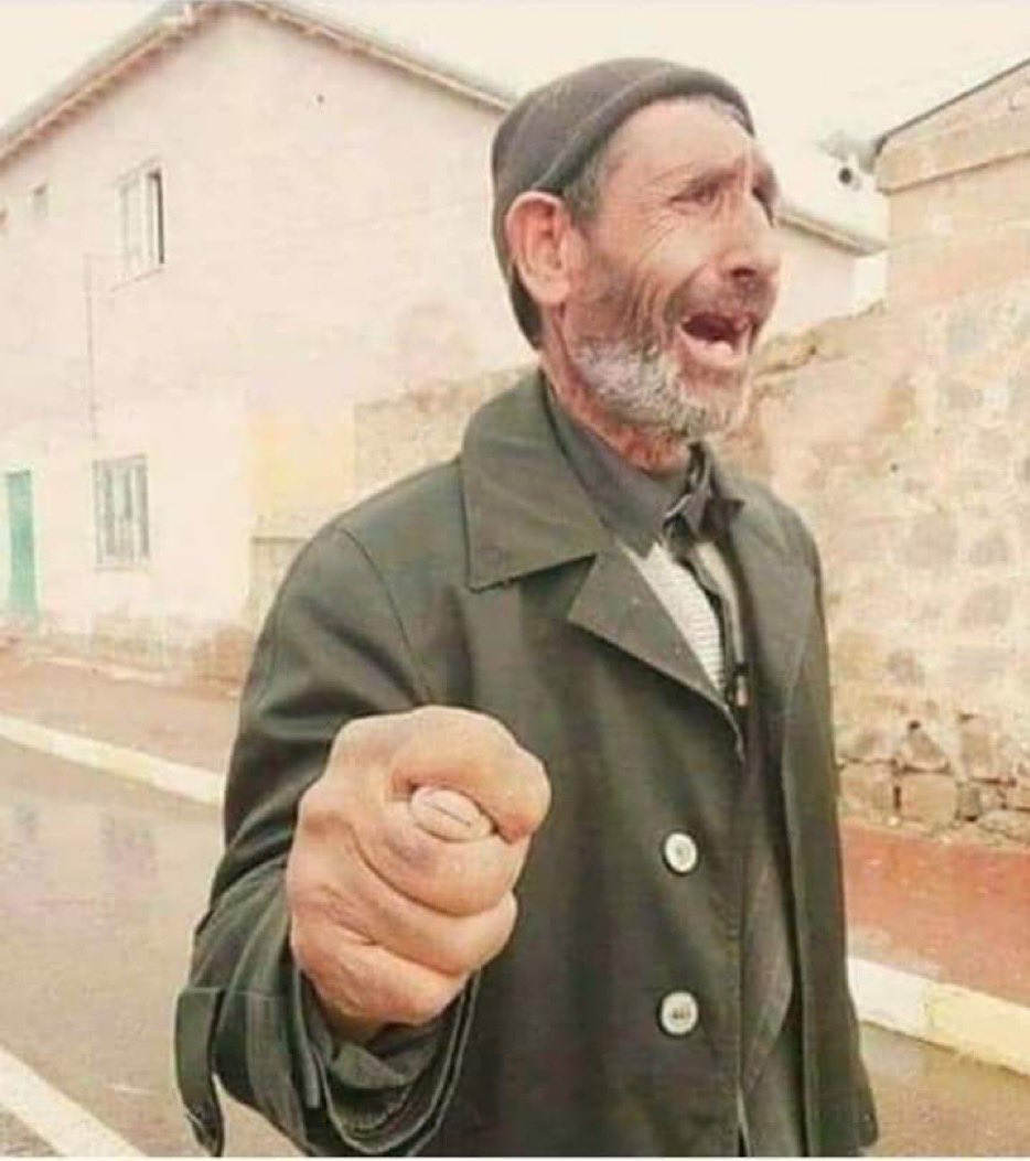 ElmalOzkan's tweet photo. @heterokromili https://t.co/au8Ic8Xom1