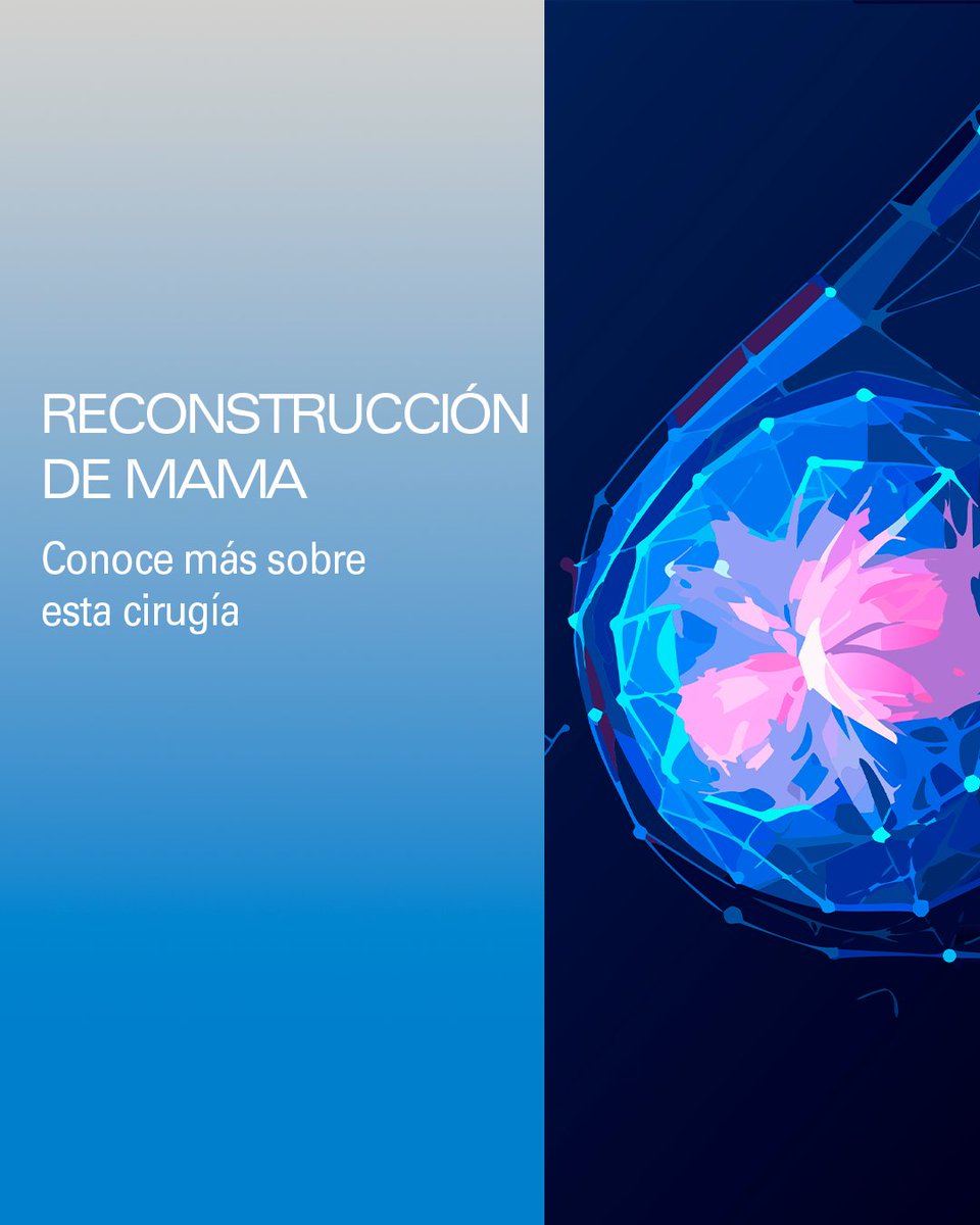 MDAnderson_ES's tweet photo. En la cirugía de reconstrucción de la mama, un cirujano plástico recrea total o parcialmente una mama que ha sido extirpada quirúrgicamente. Se lleva a cabo con un implante mamario o con tejido procedente de otra parte del cuerpo. El objetivo de la reconstrucción es que la mama muestre un aspecto natural y equilibrado cuando la paciente esté vestida.​

Entre las candidatas a reconstrucción de la mama figuran las mujeres que:​

🔹Han sido diagnosticadas de cáncer de mama y se han sometido o van a someterse a una mastectomía.​
🔹Han sido diagnosticadas de cáncer de mama y se han sometido o van a someterse a cirugía con conservación de la mama.​
🔹Son portadoras de una mutación genética.​
​
Con las mejoras de los tratamientos, las técnicas de reconstrucción de la mama y los nuevos dispositivos médicos existen distintas opciones. Los cirujanos pueden recrear una mama en el momento de la mastectomía o tras haberse sometido a ella. También pueden corregir mamas de forma defectuosa que pueden ser resultado de intervenciones con conservación de la mama.​

#MDAndersonCancerCenterMadridHospiten #CáncerDeMama
