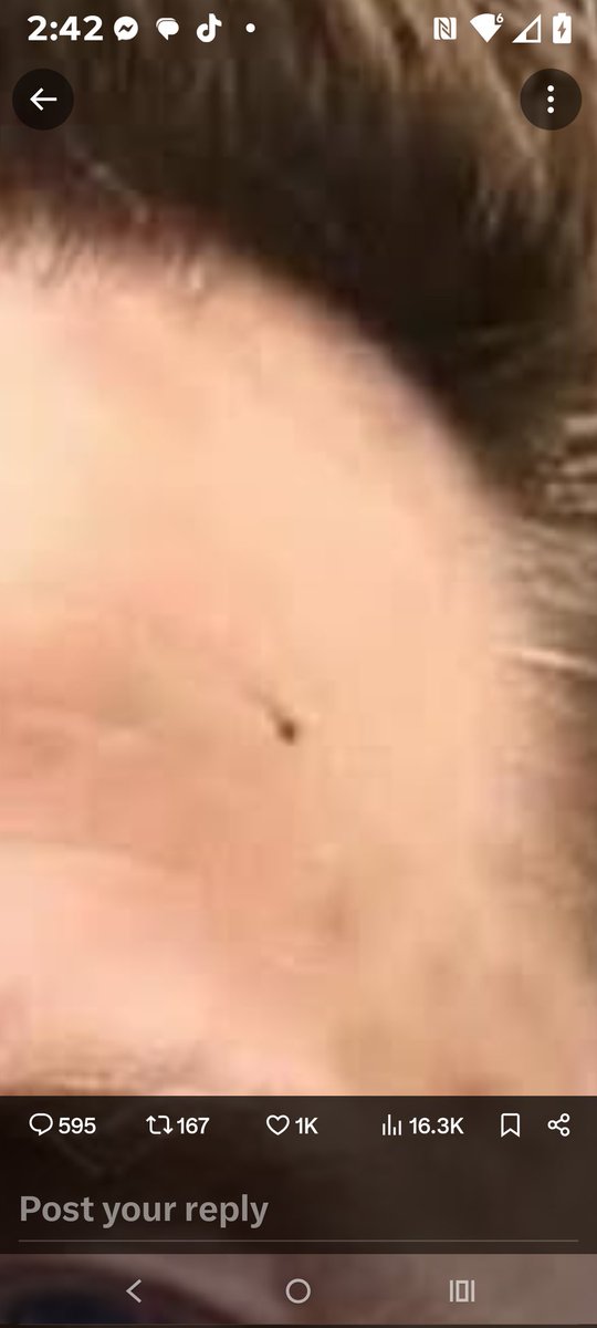 panzermeiyer's tweet photo. @WeloveElon56 Or could it be the oddly symmetrical marks on Elons  forehead which perhaps due to some genetic similarity in the DNA and RNA also seem to be forming on the little guys forehead https://t.co/pUx5AUztU3
