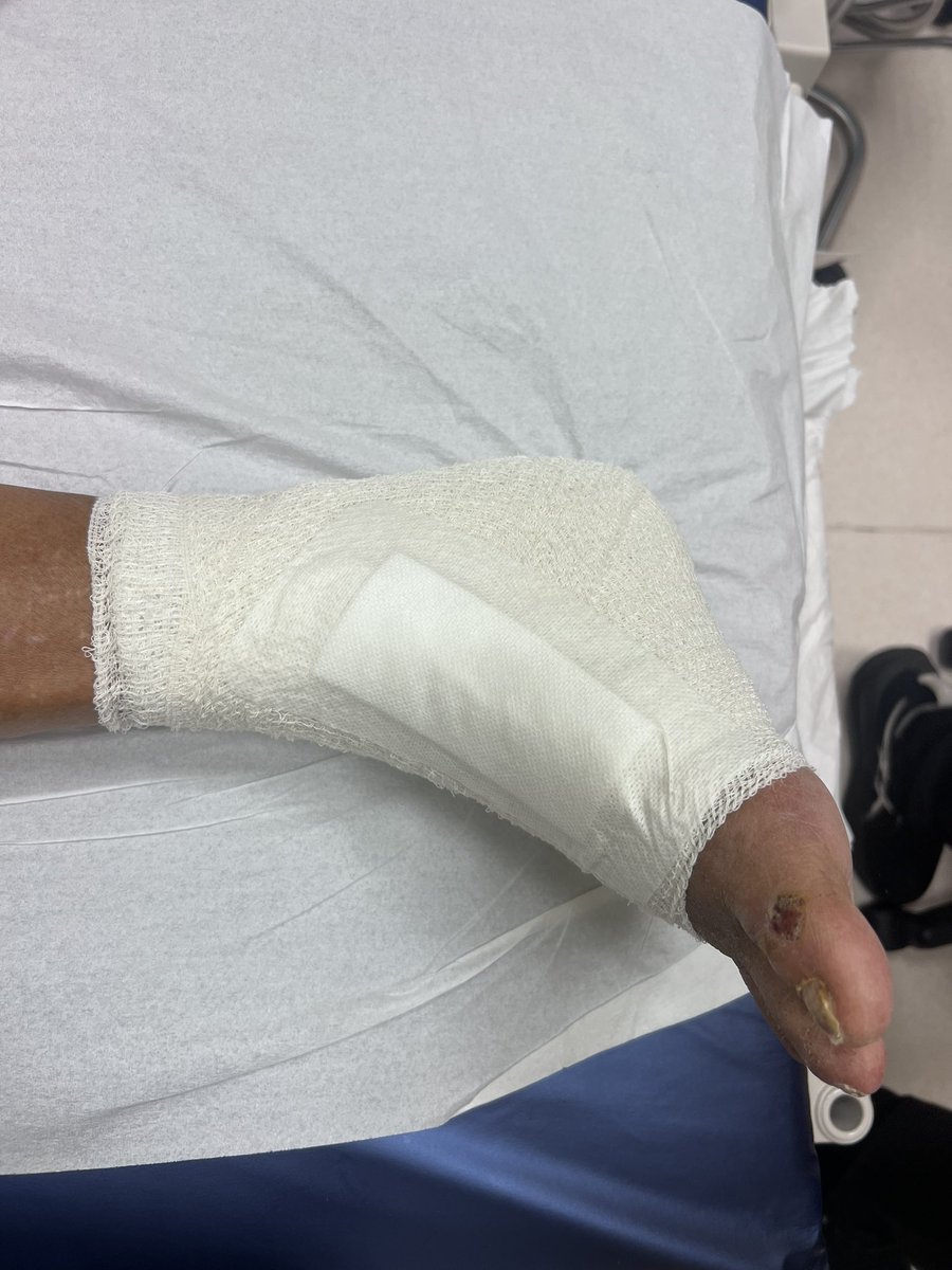 saeedalsuhaimi's tweet photo. تأميني VIP كيف المسكين اللي تأمينه عادي @IA_GOV @IA_GOV للأسف هذة قدم والدي الوحيدة حيث ان له فقط رجل واحدة نحافظ عليها محافظة اشد من انفسنا ومن عيالنا نغير على جرحة يومياً مرتين لها اسابيع لم تلتأم هذا الذي يحفر في قدمة بسبب نقص التروية الدموية في القدم ( سدد الاوعية الدموية ) وتحتاج لقسطرة ولو طولت قد تصاب بالغرغرينا ثم قد نصل للبتر
اذا استمرت الشركة التعاونيه بالرفض @Tawuniya 

مؤس�� جداً انني تواصلت معهم وشرحت كل شي ولم يفيدنا ذلك بشي الدكتور من أكفاء الاطباء السعوديين قدم كل كل المبررات من تحاليل ومن اشاعات ومن وصف كافي لأجراء ذلك وكررت الاعتذار لعدم وجود مبررات ماهو المبرر المطلوب دام كل الاشعات ضعف التروية 

مع ذلك رفضت العمليه ماذا امامنا الان هل نسلم وخلاص ونعتبر التأمين بلا قيمة