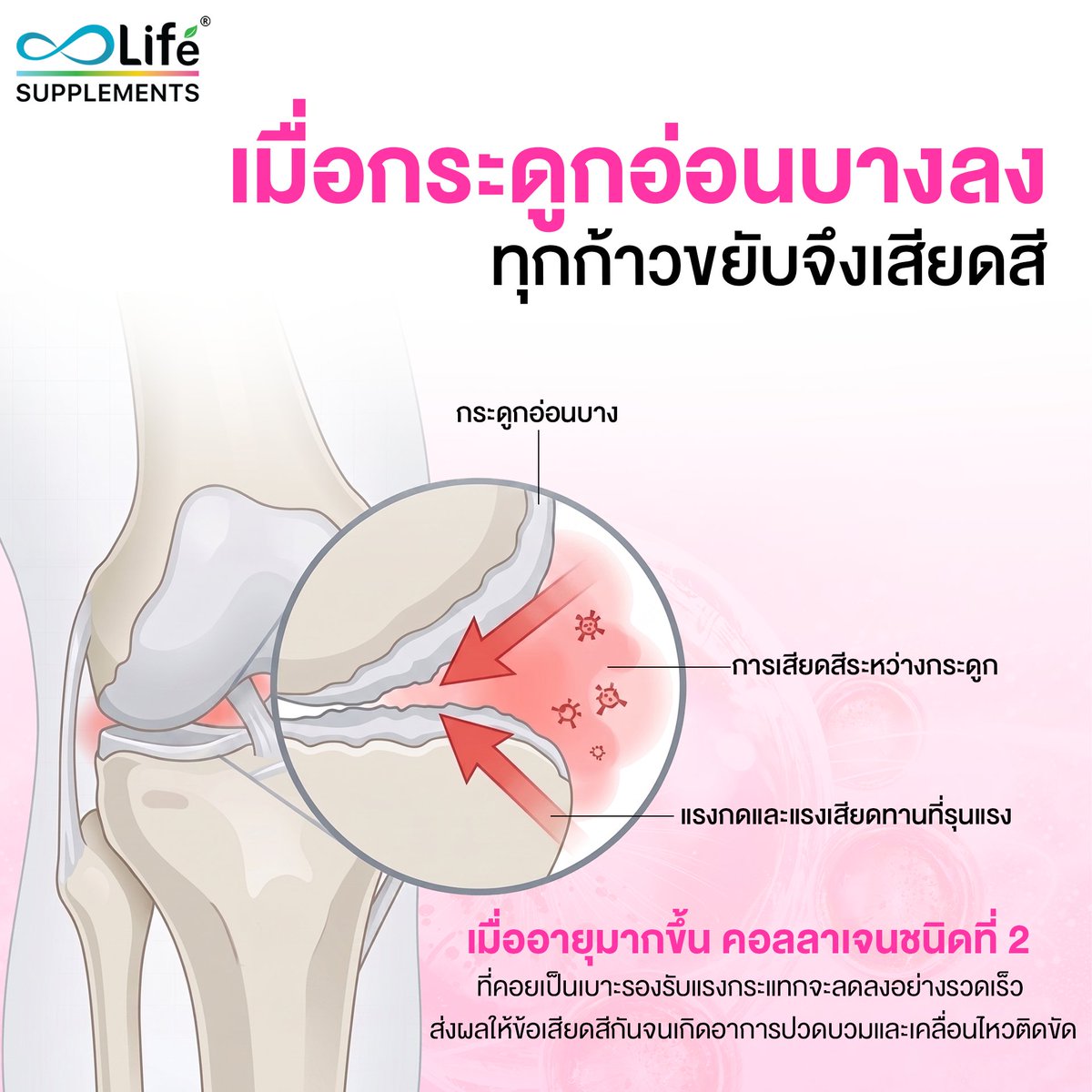 life_supplement's tweet photo. เดินเหินลำบาก เสียวแปลบที่ข้อเข่าตลอด 🤦♀️
.
ต้นตอเพราะกระดูกอ่อนสึกหรอทำพิษ 📉
ลองเติมคอลลาเจนไทป์ทูเข้มข้น
ตรงเข้ากู้เบาะรองกระแทก คืนก้าวที่มั่นใจ
.
#LifeSupplements #CollagenTypeIIPlus #ข้อเข่าเสื่อม https://t.co/V19jisWeKY