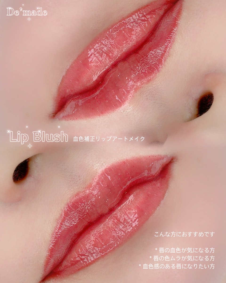de___made's tweet photo. 👇こんなリップアートメイクもできますか？✨
•くすんだ唇 ➡ 明るく血色感のある唇
•輪郭がぼやけた唇 ➡ 自然でくっきりとした唇
•薄い唇 ➡ ふっくらとボリュームのある唇
•ティントを塗ったようなグラデーションリップ

もちろん、すべて可能です💕✨
ドメイドでは、デザイン・施術方法・カラー・発色の濃さまで、17年経歴を持つ代表院長が一つひとつお客様と丁寧にカウンセリングを行いながら決めていきます😌

#釜山アートメイク #韓国リップアートメイク #韓国リップ #韓国口紅 #韓国旅行 #韓国ワーホリ #釜山観光