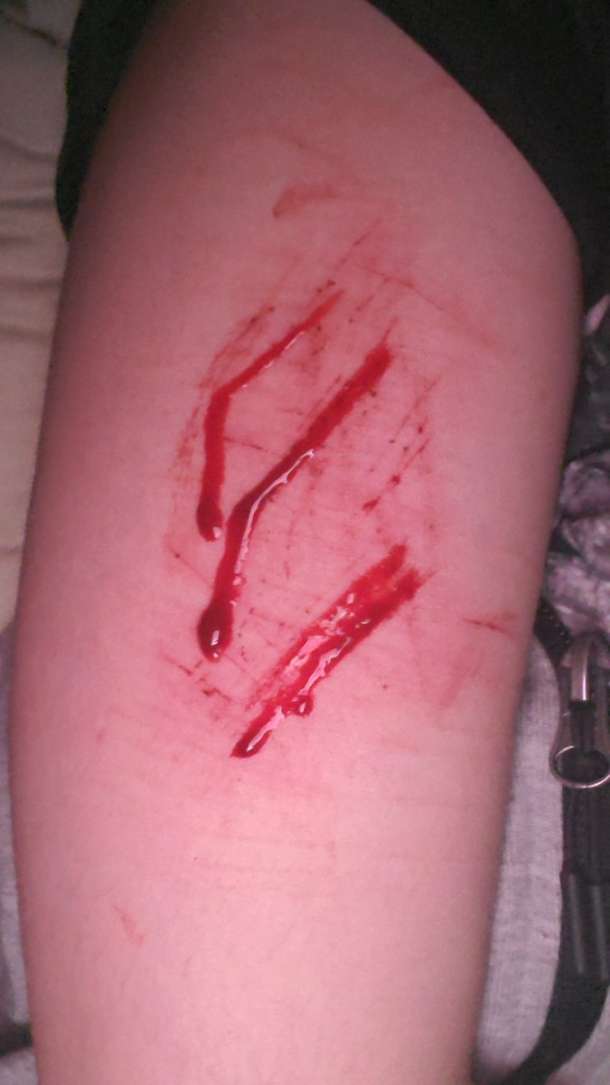 Naos0a's tweet photo. ALL FAKE SFX MAKEUP AI GENERATED NOT REAL AND NOT PROMOTING SELF HARM

I miss cutting on my arms but I can't Ith the summer :[ 
Can't wait for the winter 💔 https://t.co/jALljVCZrz