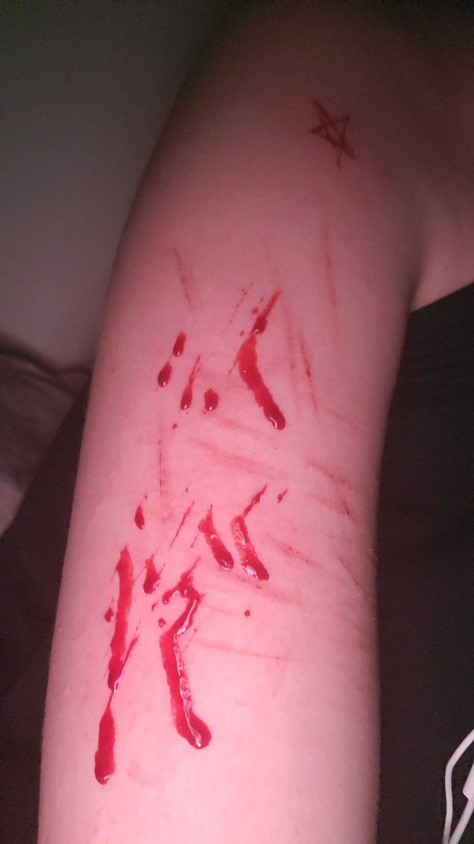 Naos0a's tweet photo. ALL FAKE SFX MAKEUP AI GENERATED NOT REAL AND NOT PROMOTING SELF HARM

I miss cutting on my arms but I can't Ith the summer :[ 
Can't wait for the winter 💔 https://t.co/jALljVCZrz