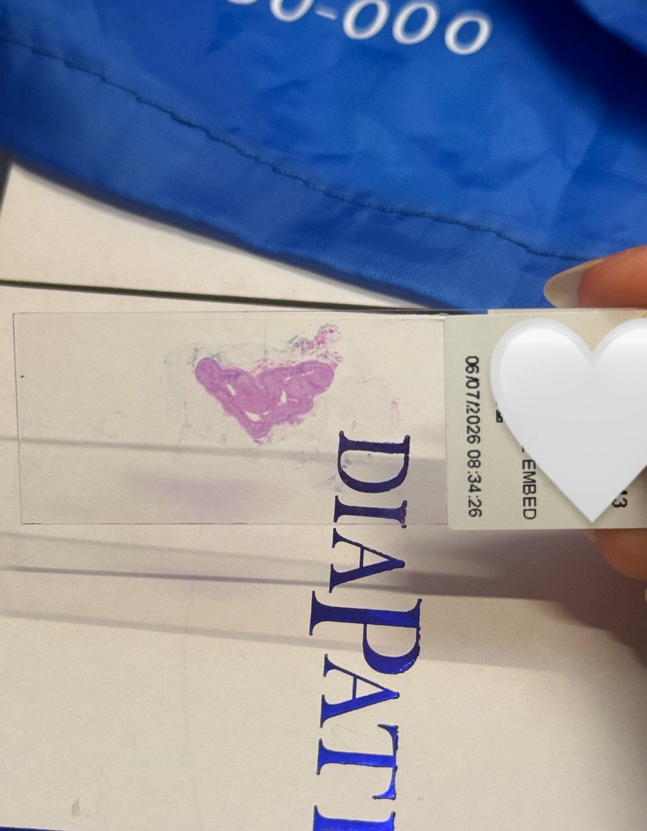 Gspathway's tweet photo. The resident had us trying to identify the organ microscopically and we couldn’t figure it out until she told us to look at the actual slide with our eyes….
One of the very few specimens where you can actually make out the organ’s silhouette on the slide
This was so funny😭 https://t.co/G56tiSMpJG