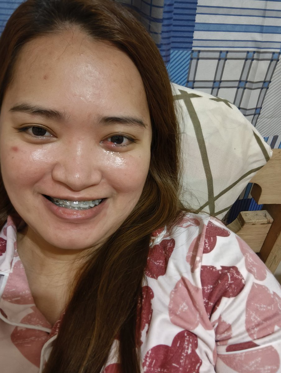kayetherine's tweet photo. Pangiti-ngiti lang pero dumudugo na. Oops not muta, just gamot. https://t.co/RNCOhmxJ1U