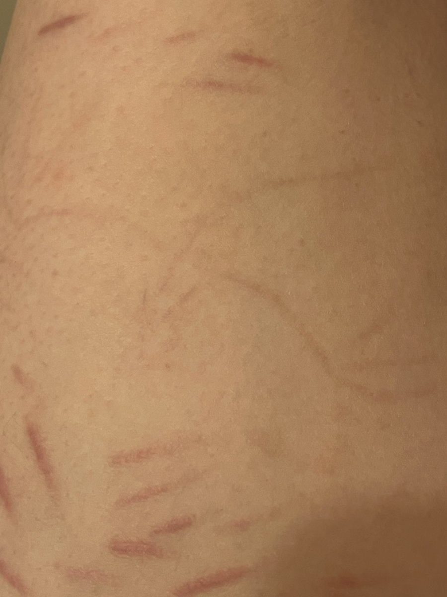 KetchupCustard's tweet photo. A collection of weirder SKIN MARKS I have (TWITTER ITS FAKE I SWEAR) https://t.co/fnptiP6iTv
