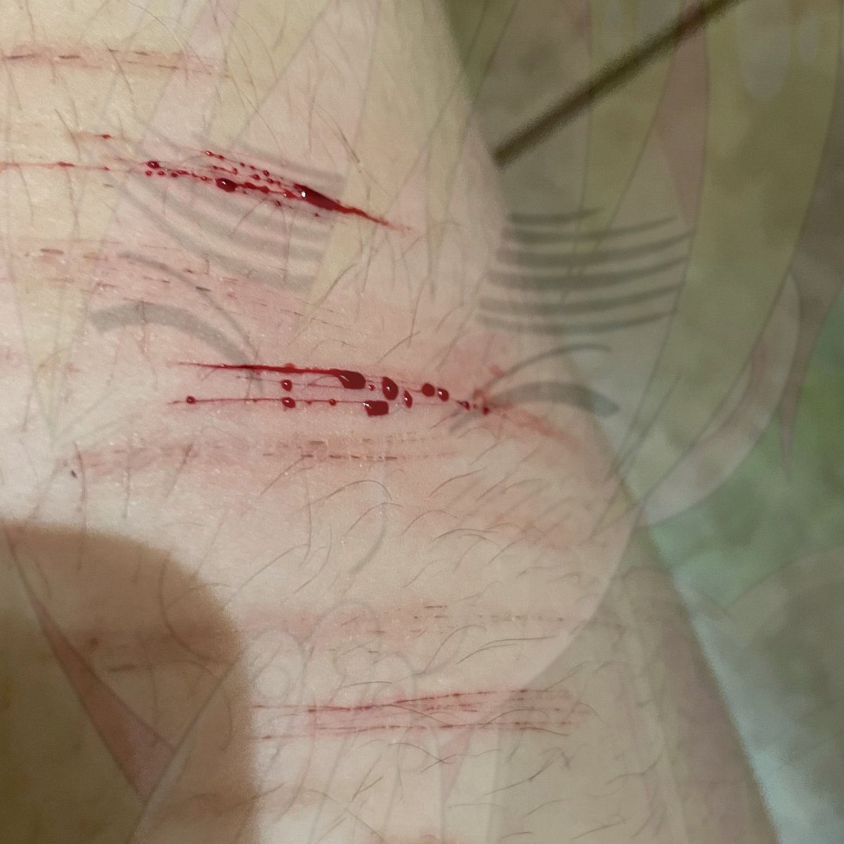 Kittencupcke's tweet photo. my cuts before vs now + scar pic #shttwt https://t.co/ERkI8a3JZP