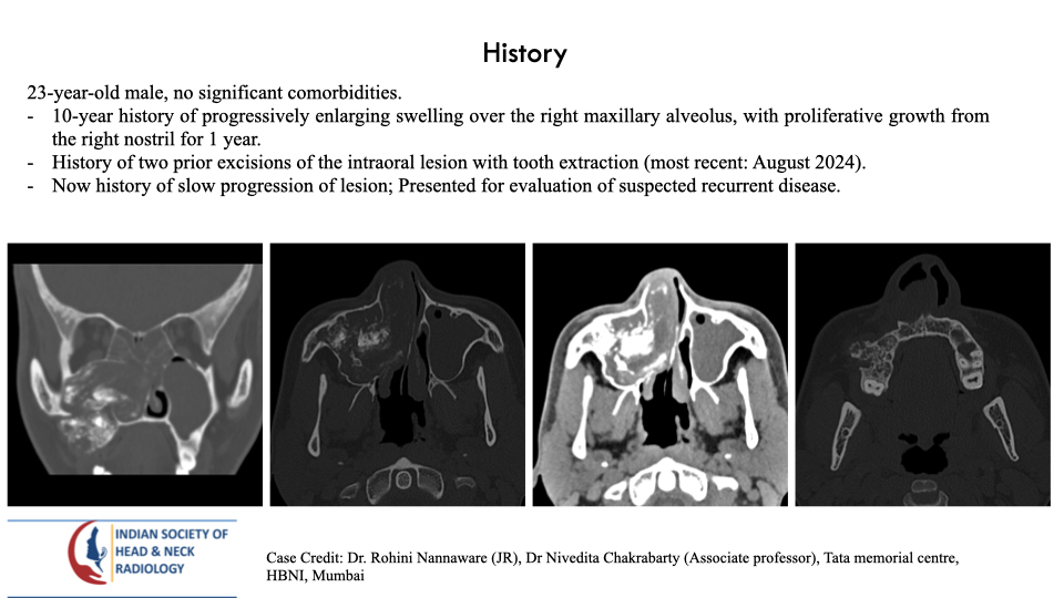 teamishnr's tweet photo. #caseoftheweek
What are the findings and DDx?
The answer will be uploaded tomorrow
#radiology #caseoftheweek #headandneck #radiologycases #dailywork #ISHNR #teaching #research #imaging #FOAM #FOAMRad #FOAMed
Visit our website: https://t.co/9KlZmntJ98 https://t.co/sDvk07ejZv