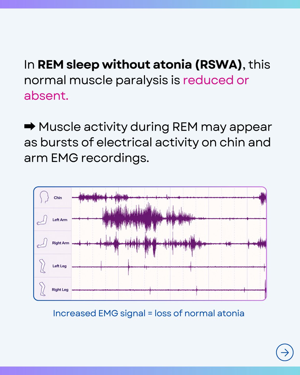 SHAS_study's tweet photo. ❓ What is REM sleep without atonia (RSWA)? Swipe to learn more! ➡️ https://t.co/TicTXbQdtC