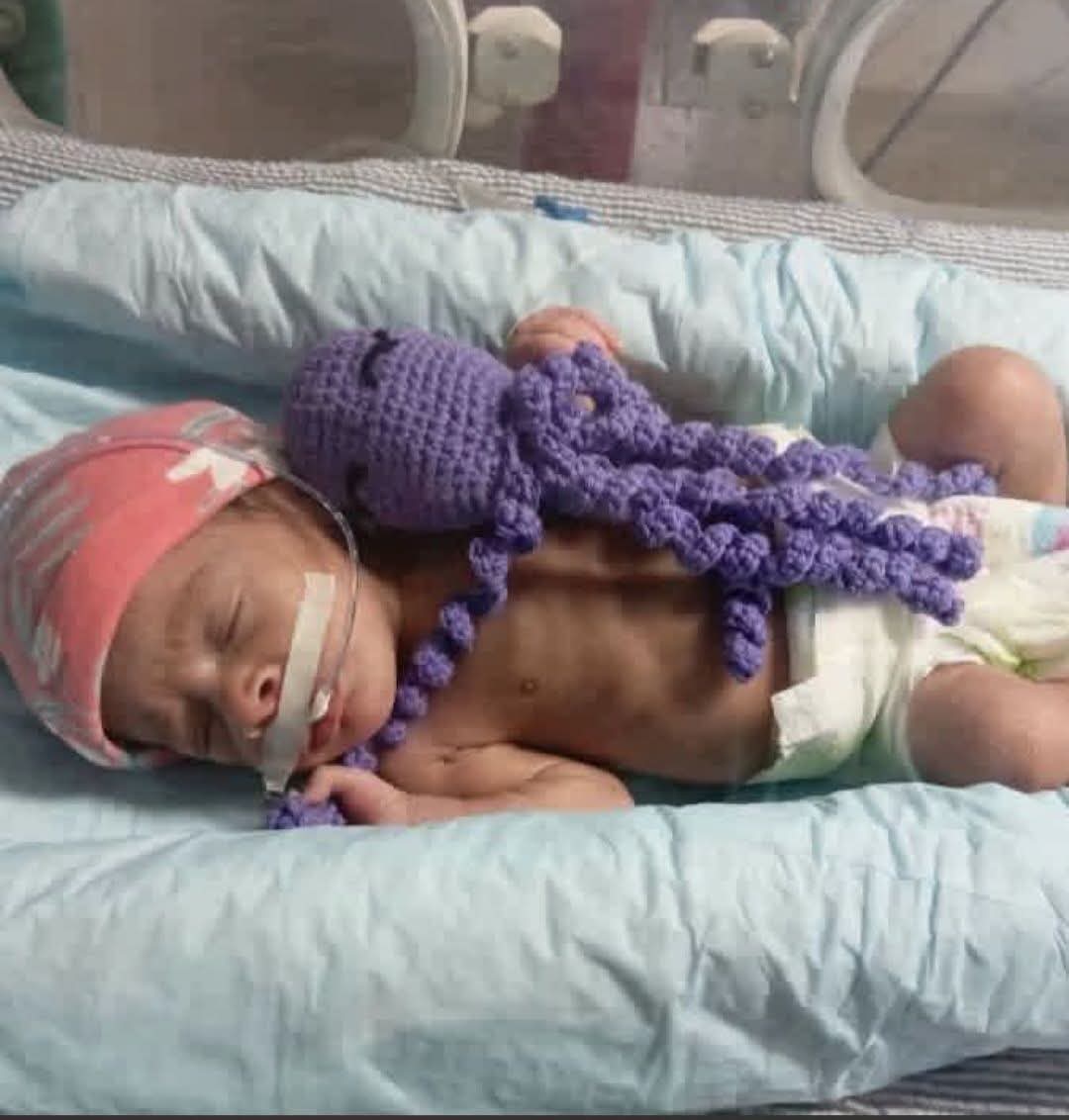 YamileRamosCord's tweet photo. #PinardelRío 
comenzó el uso de pulpos neonatales o pulpos de apego para recién nacidos. Sus tentáculos simulan el cordón umbilical, lo que ayuda a los bebés a sentirse en un medio similar al intrauterino. #CubaPorLaVida #PinarEn26 @DiazCanelB @DrRobertoMOjeda https://t.co/zh5s2CFdAc