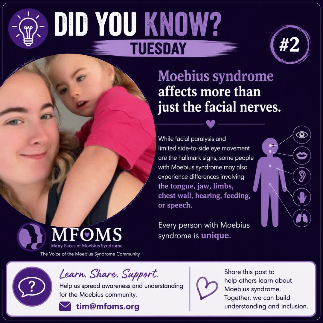 team_moebius's tweet photo. #moebiussyndrome https://t.co/qNouiTLcRc https://t.co/v2Iwd3K3vz