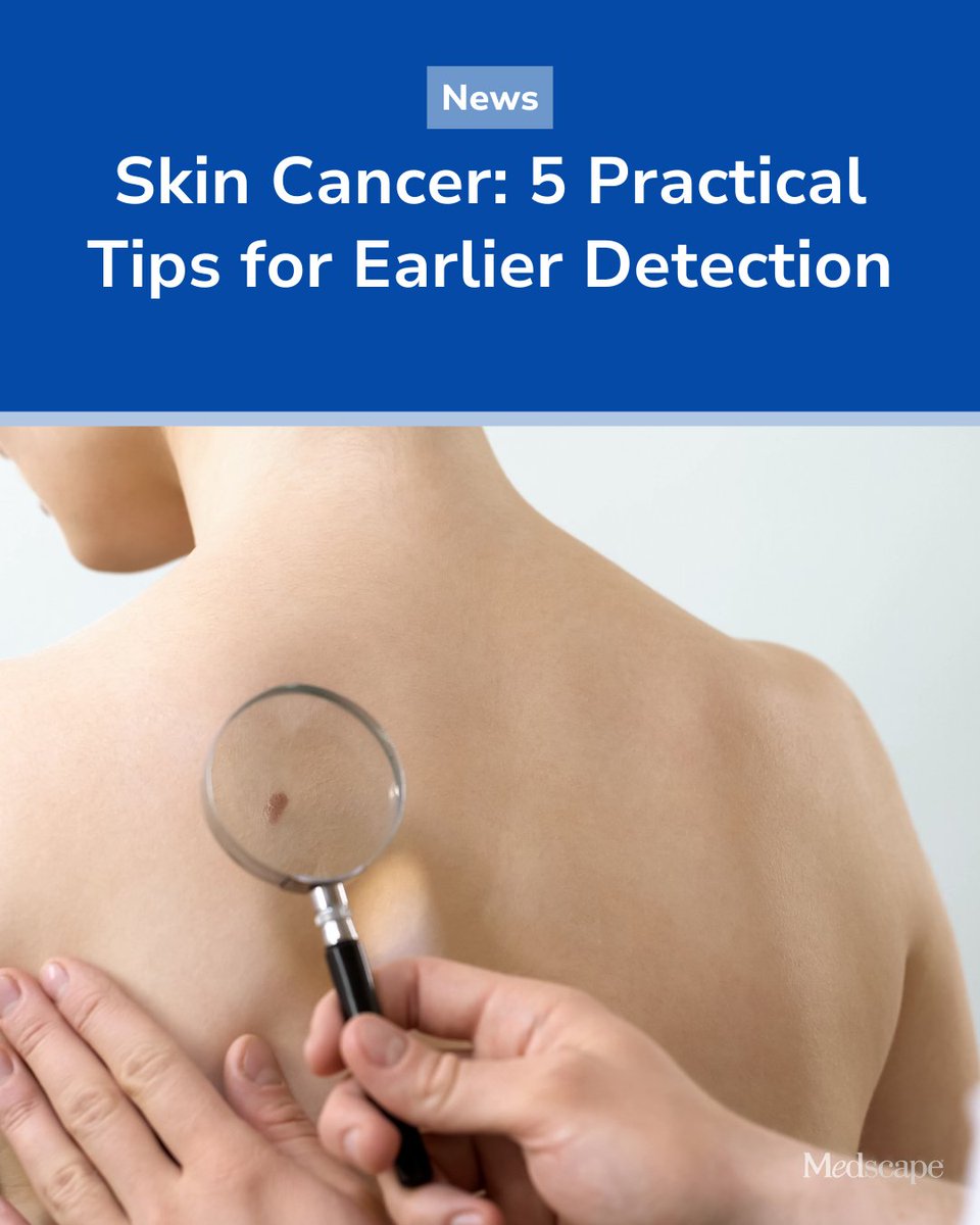 Medscape's tweet photo. Melanoma, basal cell carcinoma (BCC), and squamous cell carcinoma (SCC) have become increasingly common. Early diagnosis and treatment are essential because prompt diagnosis substantially improves the likelihood of curative treatment. The following five practical strategies can help clinicians systematically evaluate suspicious skin lesions during routine clinical practice.

The ABCDE rule remains a simple and practical tool for systematically evaluating pigmented skin lesions. More on the ABCDE rule: https://t.co/WXB3SKS89O