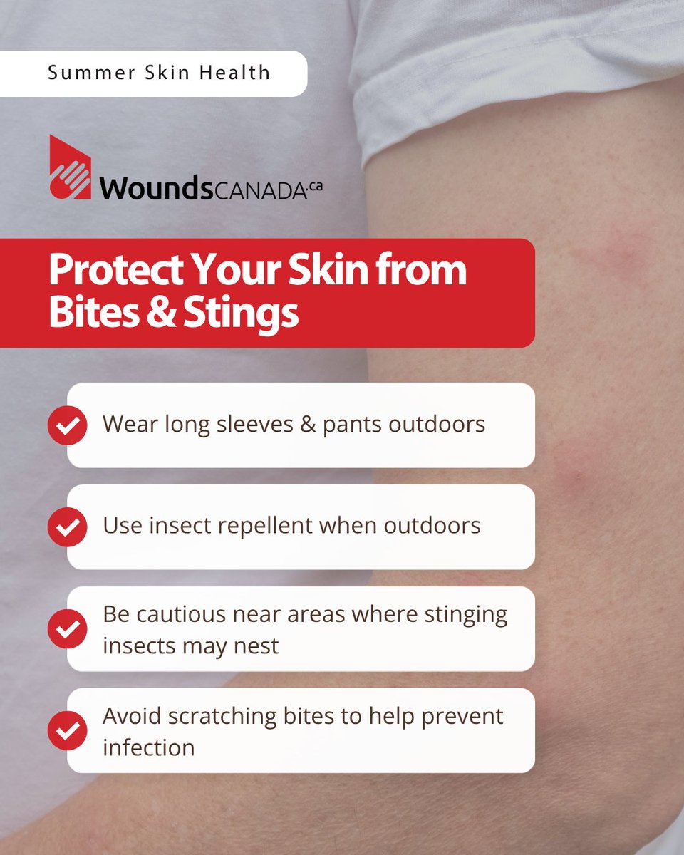 WoundsCanada's tweet photo. 🦟 Enjoy summer bite-free! Wear long sleeves, use insect repellent and stay alert around nesting areas.

If you get a bite, avoid scratching to reduce infection risk. 🐝

#SummerSkinHealth https://t.co/rCFj4NOJNr