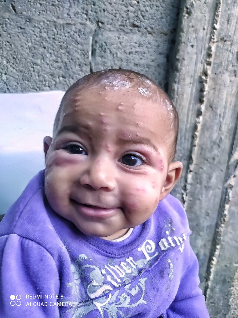 Mahmoud 🍉𝕏 tweet media