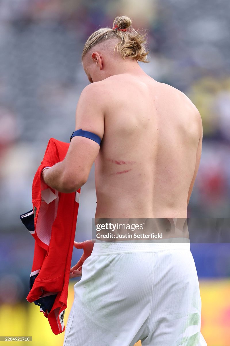 heyymandi's tweet photo. OS ARRANHÕES KKKKKKKKKKKKKKKKKKKK https://t.co/TzByPhWWQe