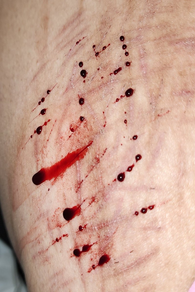 alphabingus's tweet photo. catscratches again https://t.co/mmSsRmz5qd