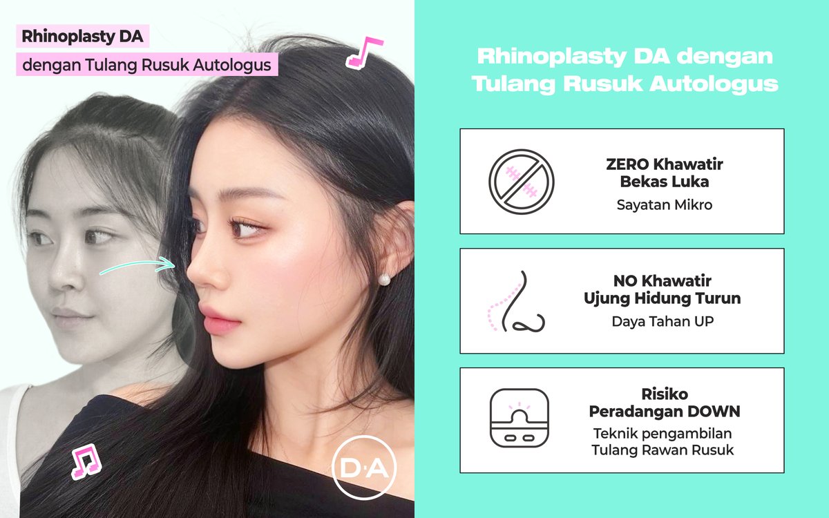 daprs_indo's tweet photo. Real Result: Rhinoplasty at DA Plastic Surgery ✨

Wujudkan hidung cantik yang natural dan proporsional sesuai karakter wajahmu. Karena setiap detail kecil menentukan harmoni wajah yang sempurna. 💖 https://t.co/zJ4ri9sk1v