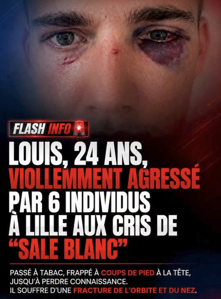 MaximeRichRNJ78's tweet photo. Pauvre garçons sa devient une habitude le racisme anti blanc existe belle et bien ! https://t.co/LUqA8Wb1n3