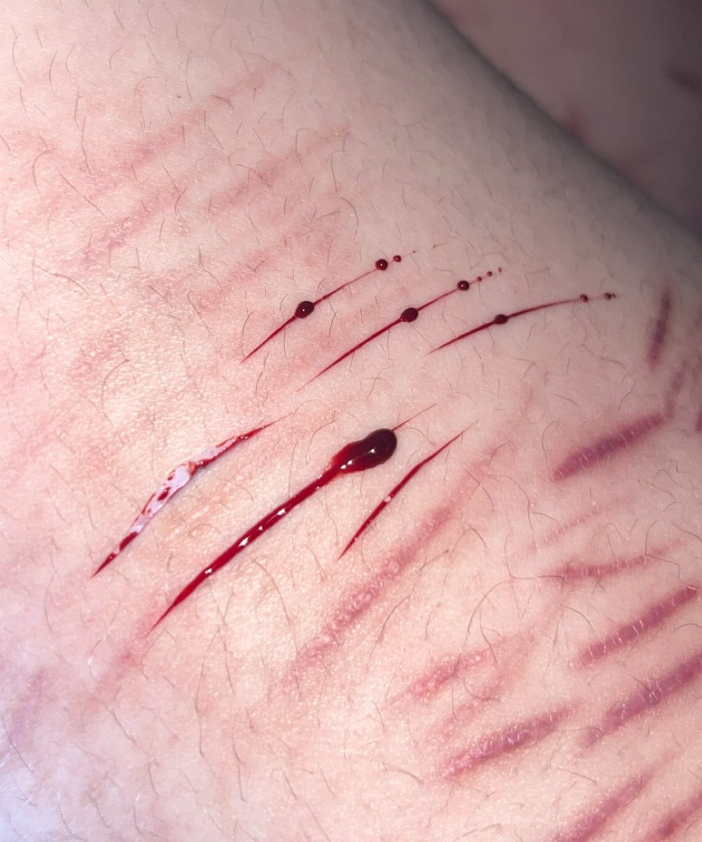 thalasaphobic's tweet photo. Oh well.. istg it twt takes my ai generated make up down AGAIN…
#sh #shedtwt #slittwt #shtwt #988twt
#styros #babybeans ALL FAKE PROFESSIONAL SFX MAKE UP MADE WITH HELP OF Al AND NOT REAL‼️ https://t.co/TIKchxpZHw