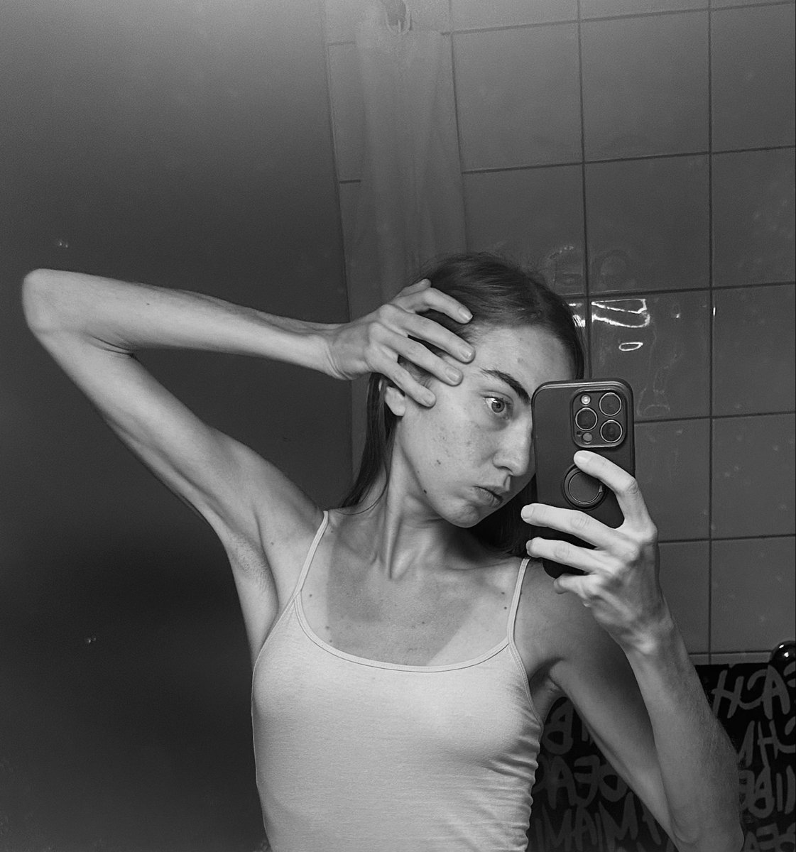 SweetTinyAngels's tweet photo. Finally bmi 15, and I do feel better..!
#edtwt #ana #proana #eatingdisorder #anorexia #rexia #edrtwt #ed #bmi15 #edrecovery https://t.co/WUdfVH8eJL