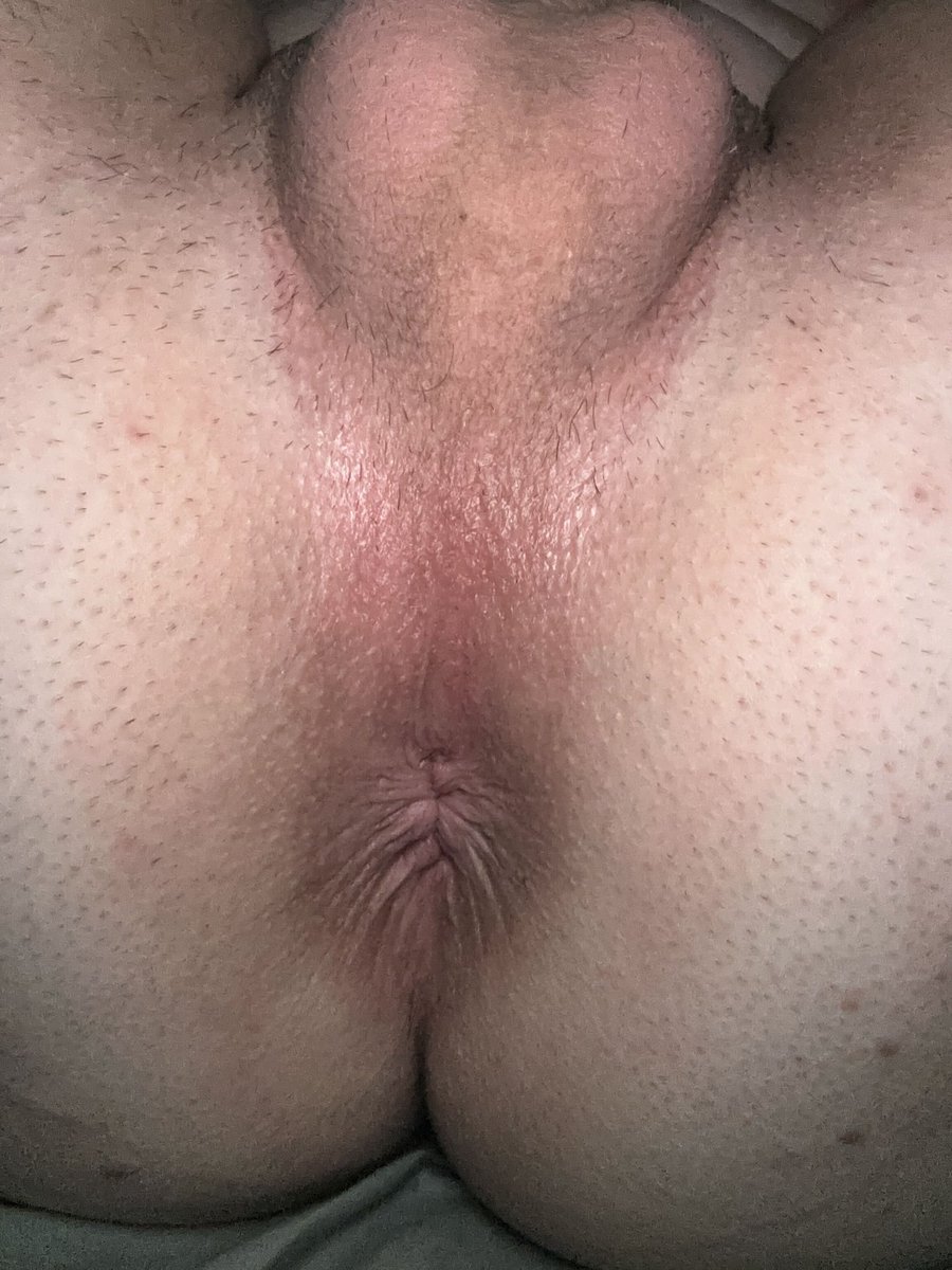 PinkyHoleBoy's tweet photo. @FeminizingBetas @pinkboochie Ass https://t.co/PaJsMYMtaQ
