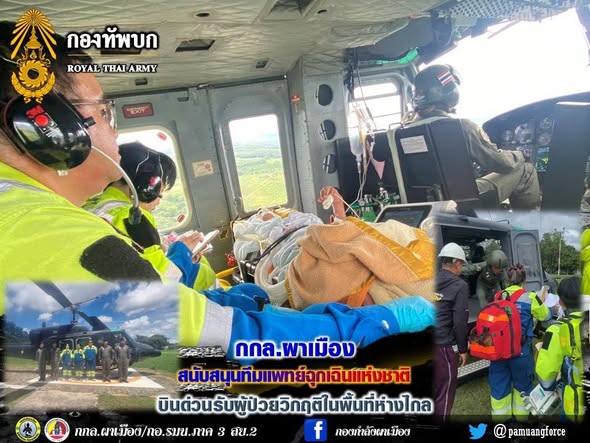 armypr_news's tweet photo. “กกล.ผาเมือง สนับสนุนทีมแพทย์ฉุกเฉินแห่งชาติ บินด่วนรับผู้ป่วยวิกฤติในพื้นที่ห่างไกล”
กองกำลังผาเมือง โดย ชุดปฏิบัติการบินทหารบก หน่วยเฉพาะกิจทัพเจ้าตาก จัดเฮลิคอปเตอร์ใช้งานทั่วไป แบบ 212 จำนวน 1 เครื่อง สนับสนุนสถาบันการแ���ทย์ฉุกเฉินแห่งชาติ (สพฉ.) โดยทีม SKY DOCTOR โรงพยาบาลเชียงรายประชานุเคราะห์ รับผู้ป่วยฉุกเฉินทางอากาศ เพศหญิง อายุ 47 ปี มีอาการหน้ามืด ล้ม ศีรษะกระแทก มีเลือดออกในสมอง ต้องผ่าตัดด่วน จาก โรงพยาบาลฝาง อำเภอฝาง จังหวัดเชียงใหม่ เพื่อเข้ารับการรักษาพยาบาลต่อที่ โรงพยาบาลนครพิงค์ อำเภอแม่ริม จังหวัดเชียงใหม่ ใช้เวลาบิน ประมาณ 45 นาที (ถ้าลำเลียงทางรถยนต์จะใช้เวลาประมาณ 3 ช��่วโมง) ผู้ป่วยถึงมือแพทย์อย่างปลอดภัย
#ศูนย์ประชาสัมพันธ์กองทัพบก