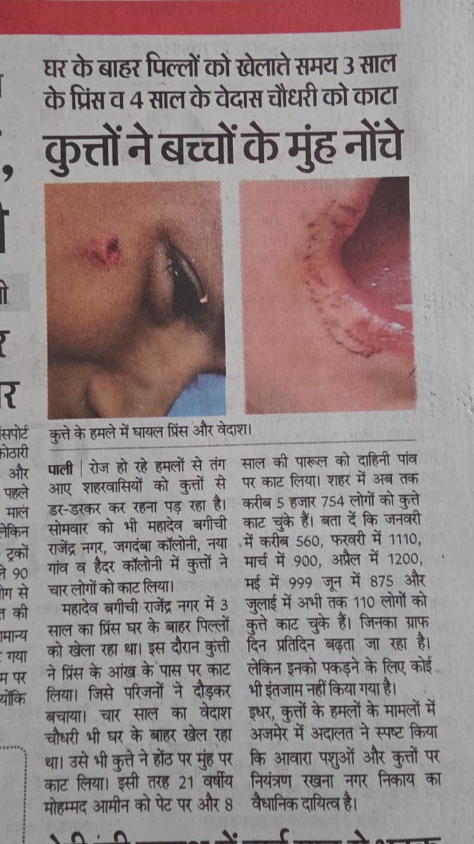 DhariwalHarshit's tweet photo. I think u don't see all this...
@PetaIndia @Manekagandhibjp 
Thousands of news like this continuously come every day due to dogs, which are becoming dominant over humans.. please keep ur love aside... https://t.co/OdWCLllTPZ