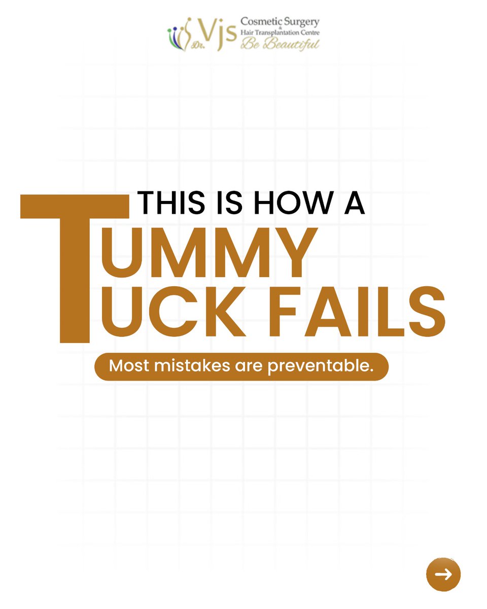 VJsclinic's tweet photo. 🚨 A tummy tuck should look natural—not obvious.

An unnatural belly button or uneven abdomen could be signs of poor surgical technique. Choose experience. Choose precision.

📍VJ's Clinics, Vizag

#VJsClinics #TummyTuck #BodyContouring #CosmeticSurgery #Vizag https://t.co/tnKbhJmMEW