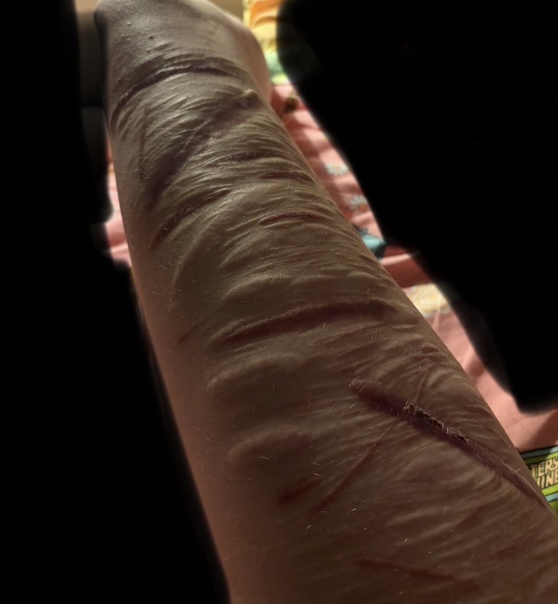 i_was_borntodie's tweet photo. ✨Scars✨
⚠️FAKE⚠️ ⚠️SFX MAKE UP⚠️ https://t.co/lvFOxZqHcp