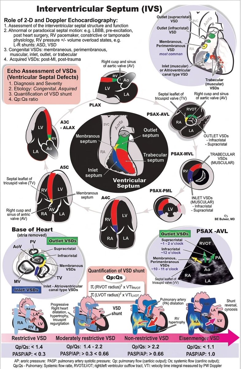 TrackYourHeart's tweet photo. Echocardiographic assessment of the Interventricular septum.
📸: BE bulwer, MD https://t.co/4MWYlA4PFz