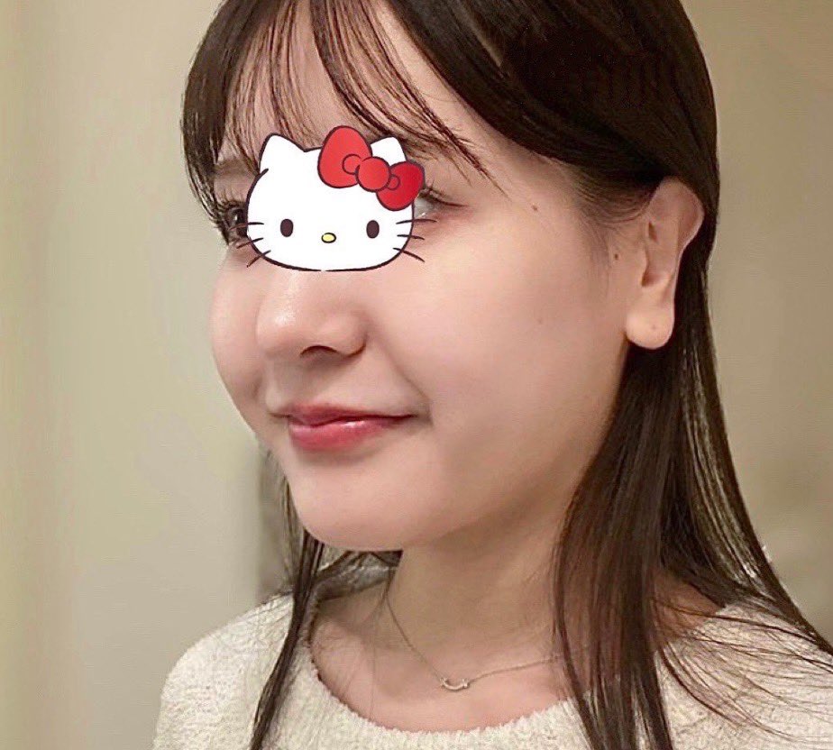chinanago5656's tweet photo. これ私もシルエット(輪郭)綺麗すぎる、、、！

やっぱ頬コケせずに輪郭の凸凹整えてリフティングしてくれるここが一番うまい

←過去　　　　　　　　　　　　　　　今→ https://t.co/3OXApeNbKb