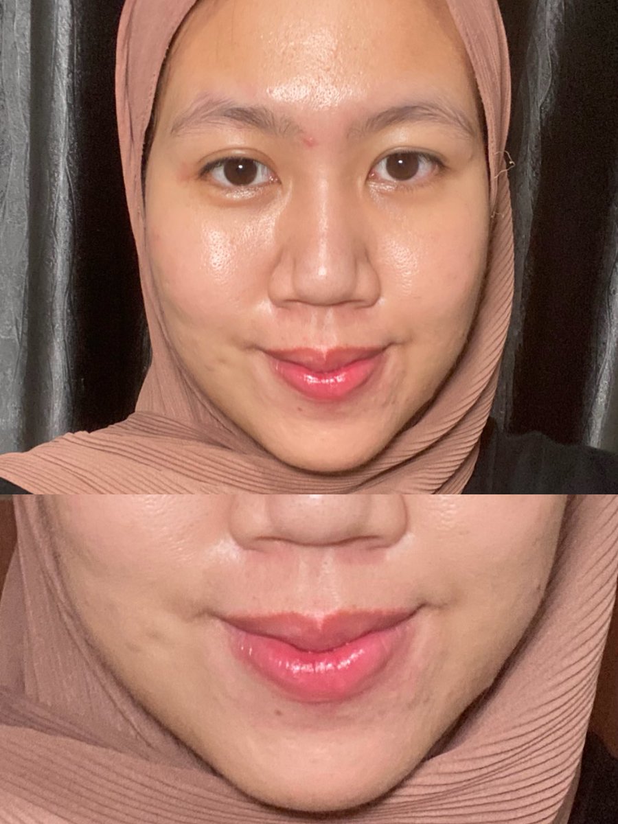 slaychiizu's tweet photo. Kakak kakak yang belum tau, ini namanya kulit cerah dan sehat tanpa bikin dompet nangis yaa💸🕊 

Cukup pake 4 basic skincare ini aja udah cukup bikin glowing tanpa takut over budget! https://t.co/yK7rFFbgHw