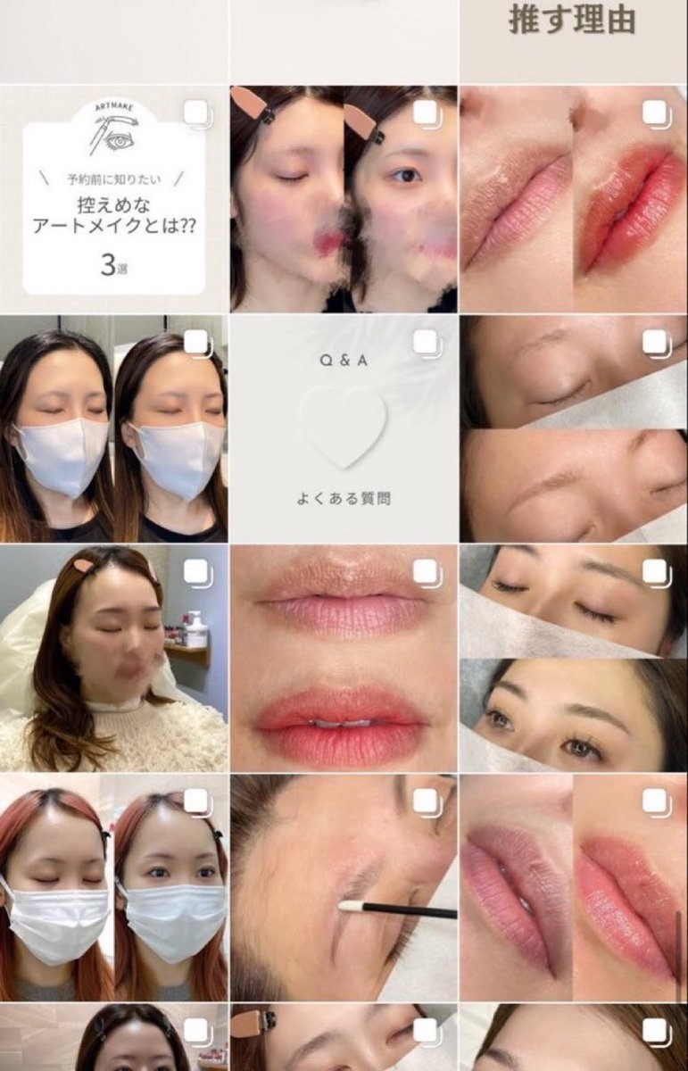 artmake_as74's tweet photo. Instagramに「症例写真」たくさんUPしているのでぜひご覧ください🕊️無料カウンセリングも受け付けています♩お気軽にご相談ください📩 https://t.co/Emz4Wdcmi3… https://t.co/Den2ZCI3j7