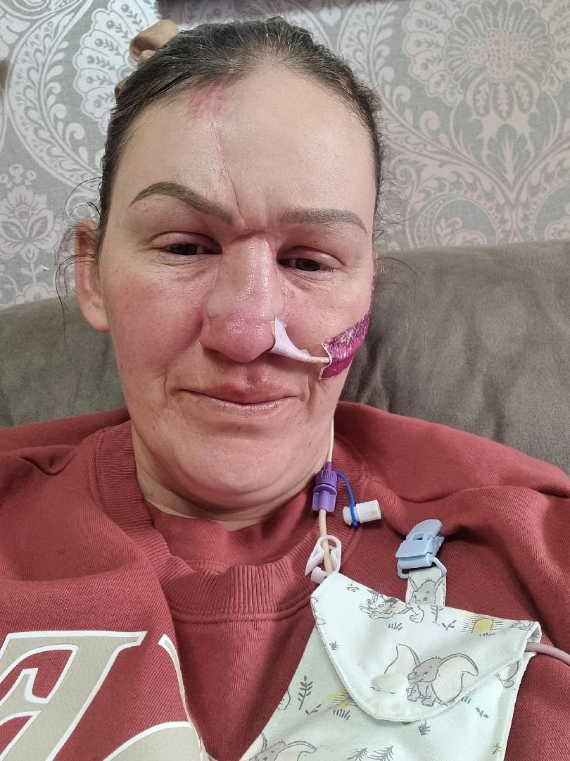 bertiehughes67's tweet photo. 💔 I have nasal cancer, and every day is a difficult battle.
The treatment is overwhelming, and I urgently need support.
Please share my story—your kindness may help me reach someone who can help.
Thank you from the bottom of my heart. ❤️
https://t.co/0RxUNG6Y9g https://t.co/gNPpK9cEOv