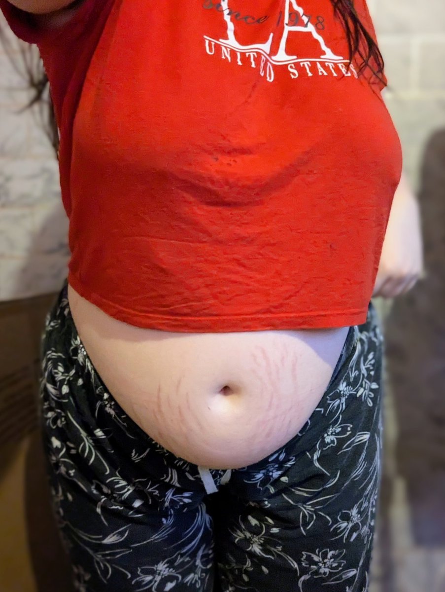 SweetpeaSquish's tweet photo. Another crop top for another hot day
⊹₊˚‧︵‿₊↻💬 ♡ ︎₊‿︵‧˚₊⊹
#bloated #stuffed #fulltummy #bbw #chubby #chubbygirl #overeating #chubbytwt #fatgirl #fat #tummy #bigbelly #stuffed #bloated #stretchmarks #croptop #smallshirt #desginedtshirt #biggirl #bellyvideos https://t.co/G9vTS8xak9