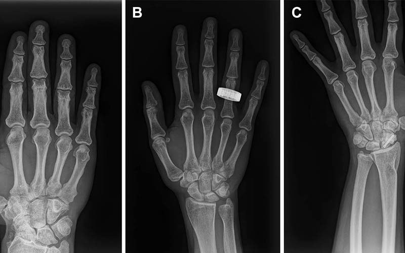 RSNA's tweet photo. Portable radiography could change how astronauts receive medical care in space. 🚀 

A study published in @radiology_rsna reports the first diagnostic X-rays acquired during orbital spaceflight. Crew members with only four hours of training used a portable X-ray system to image anatomy and equipment while in orbit.

The results show that diagnostic imaging beyond ultrasound may be feasible for future missions farther from Earth. Read more: https://t.co/nk9QAx5T3E
#MedicalImaging #ImagingScience