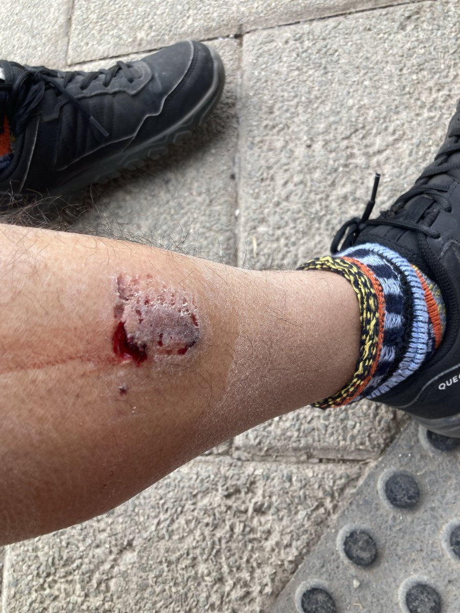 Matiasdartnell's tweet photo. …en la mano. Ahora estoy en el CESFAM de Cerro Navia. 
Necesito que se contacten.
Urgente.
Dejo mi correo y fotos.
Matiasdartnell@gmail.com https://t.co/VunJTtiBam