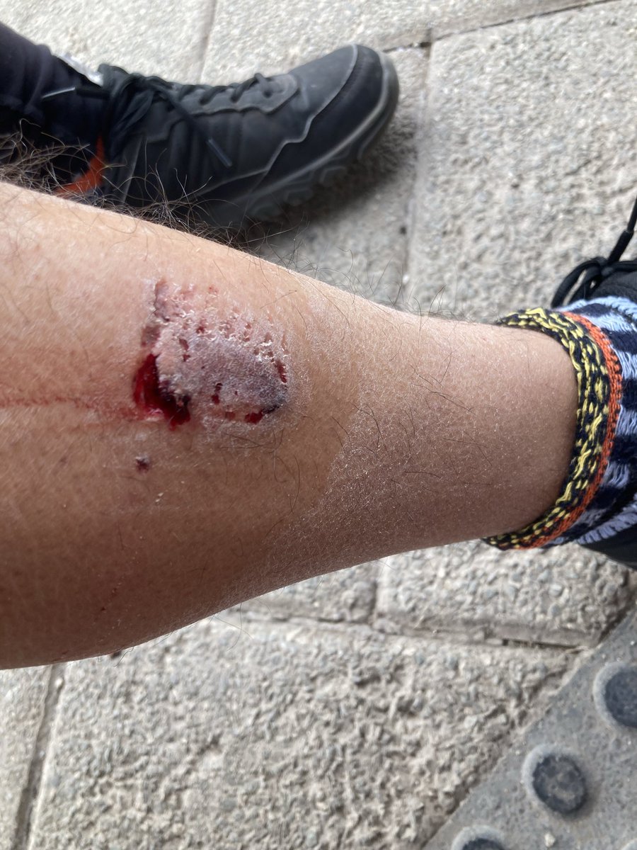 Matiasdartnell's tweet photo. …en la mano. Ahora estoy en el CESFAM de Cerro Navia. 
Necesito que se contacten.
Urgente.
Dejo mi correo y fotos.
Matiasdartnell@gmail.com https://t.co/VunJTtiBam