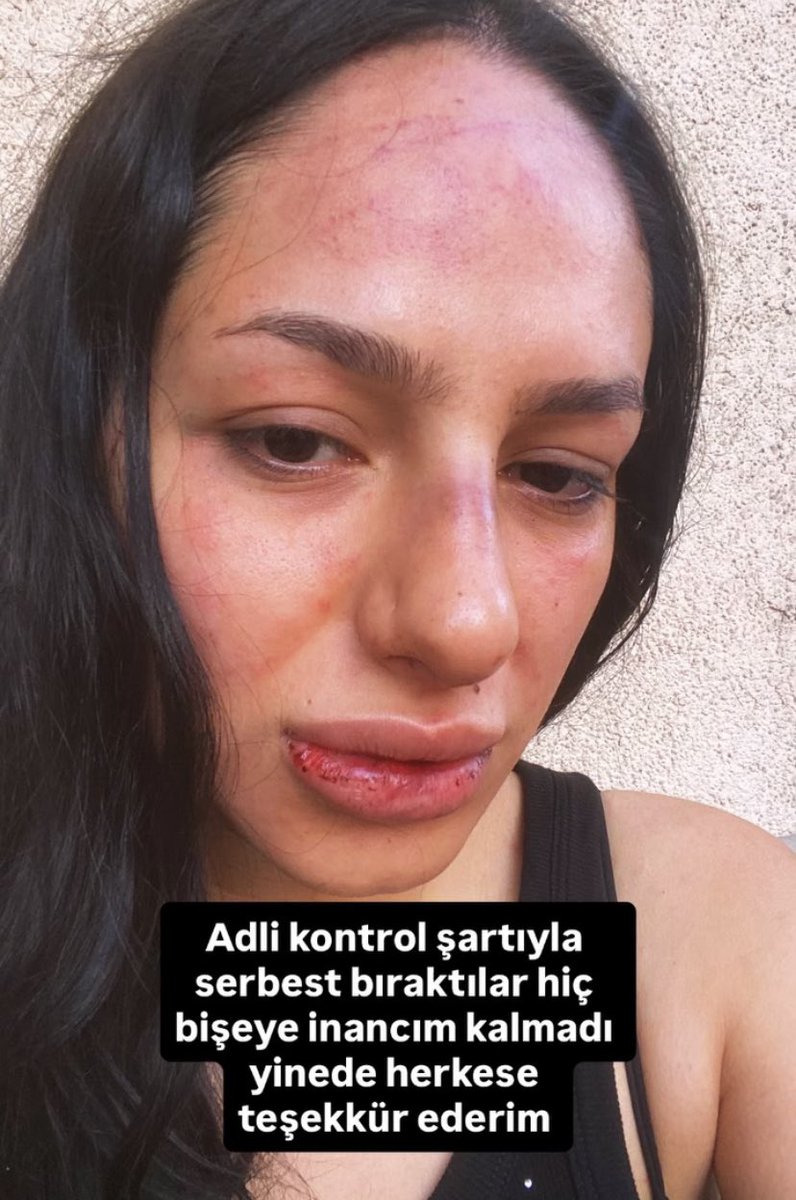 solcugazete60's tweet photo. Ebrar Tuğrul isimli kadın, Instagram’da “ebrartgrl” kullanıcı adıyla yaptığı paylaşımda yardım çağrısında bulundu:

“Hamileyim. Bu psikopattan kurtulamıyorum. Sosyal medyanın gücüne inanıyorum. Lütfen yardım edin. Kendisi daha önce cinayet işlemiş. Ölmek istemiyorum.” https://t.co/Zy0YN8FoYU