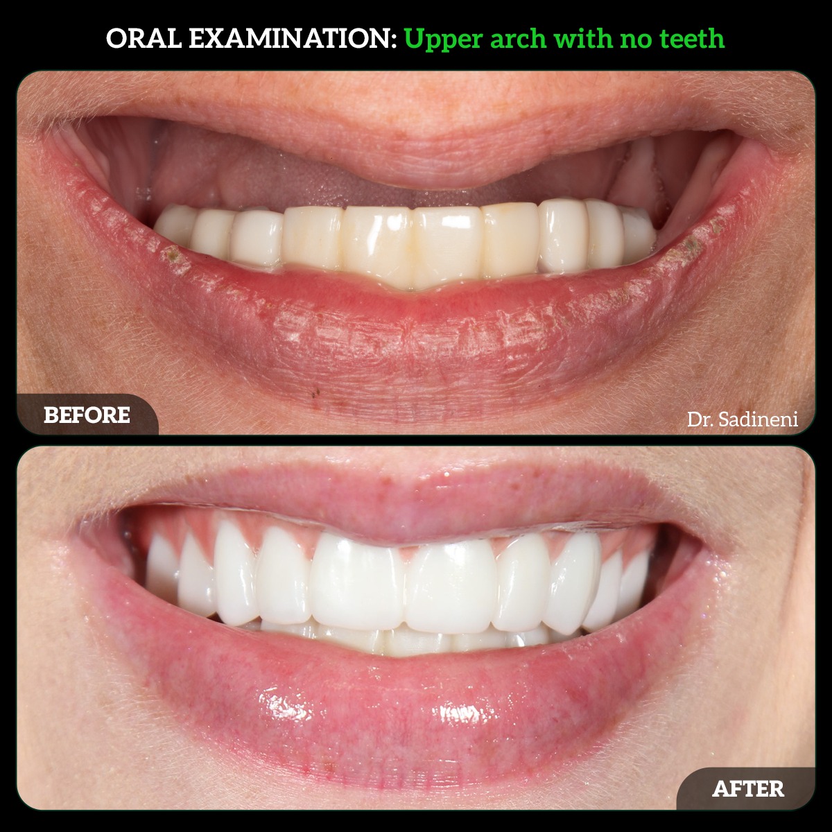 DMDGroup's tweet photo. Imagine eating, smiling, and speaking with complete confidence again 💚
📍 Dublin Metro Dental
🌐 https://t.co/cTIepI3ioF

📞 (614) 766-5600 | (614) MY-SMILE

#SmileConfidence #ImplantDentures #DublinOhioDentist #DentalImplants #FullMouthRehab https://t.co/woMr0fkbSp