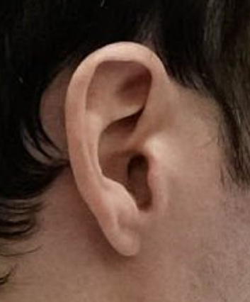 baroncoleman's tweet photo. Same ear? https://t.co/8tmhJ90FwX
