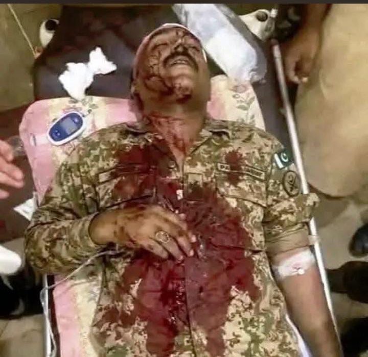 CivilKurram's tweet photo. بریکنگ نیوز کُرم ایجنسی 🚨🚨

اپر کُرم ایجنسی کے علاقے خیواس میںTTP خوارج کی شیعہ طور ی قبائل کی سہولت کاری میں FC قلعے پر حملہ ایک جوان شہید ۔یہ علاقہ افغان بارڈر تک شیعہ طور ی قبائل کے قبضہ میں ہے ۔
آیت اللّٰہ محسن نقوی پاکستان کو لبنان بنانے کے مشن پر عمل پیرا ۔ https://t.co/AqgxkogFkx
