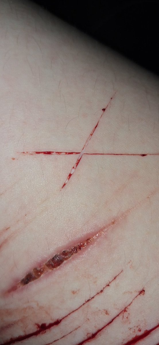 ___scummbag___'s tweet photo. !!SFX MAKEUP FOR HORROR MOVIE!!
My posts keep getting removed ๐ #sshtwt #shedtwt #998twt #slittwt https://t.co/SwmFzL1G0n