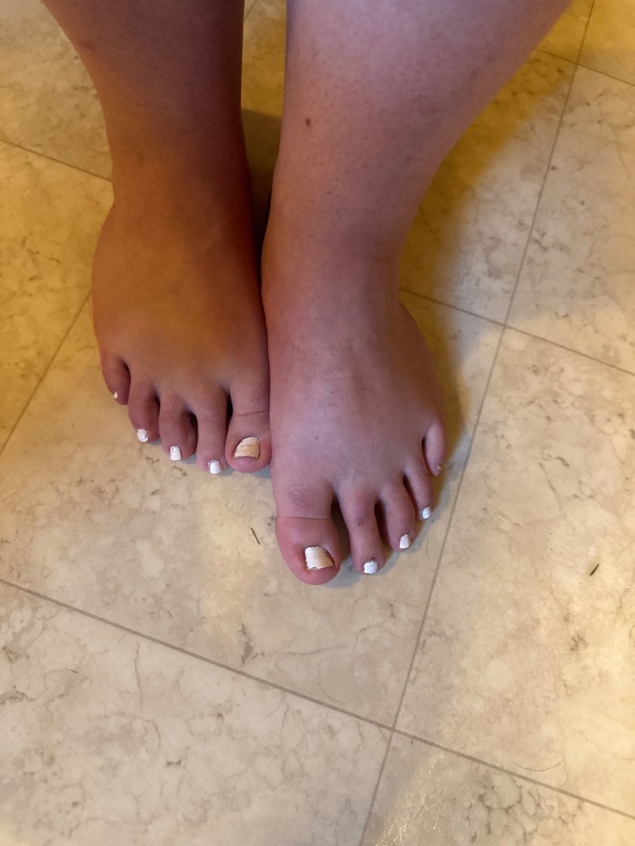 ToeTeaser245's tweet photo. @BSOD_BSOD Hey😊 https://t.co/wDo9r4dSRN