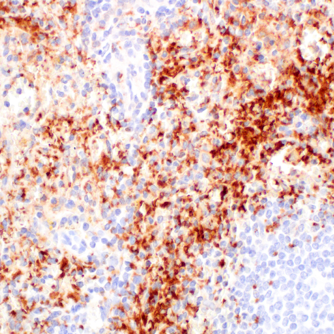 CellSignaling's tweet photo. 【新製品のご紹介】 
血小板受容体のサブユニットであるCD42d (GPV) は、コラーゲンと相互作用し、血小板活性化中にトロンビンによって酵素的に切断されることが知られています。
#70237 は、ヒトサンプルを用いたWBとIHC-Pに適しています。
https://t.co/sSpRVmQ8qv https://t.co/fXopwsnypI