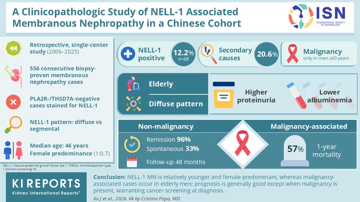 KIReports's tweet photo. A Clinicopathologic Study of #NELL-1 Associated #MembranousNephropathy in a #Chinese Cohort
#VisualAbstract by @CristinaDeReins
https://t.co/rxbZooUmag
@jingxu343098 https://t.co/X7LdKrlFUx