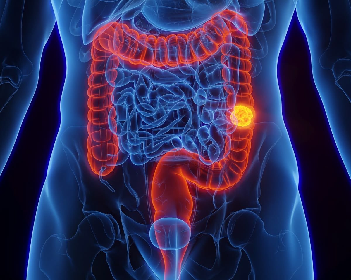 AscendenciaX's tweet photo. El cáncer rara vez comienza con un dolor insoportable.

Por lo general, empieza con una molestia leve que decides ignorar.

Estos son 6 signos de advertencia tempranos para tipos comunes de cáncer que nunca debes ignorar.

1: cáncer de colon = sangre en las heces. https://t.co/0ZNAhHEX2y
